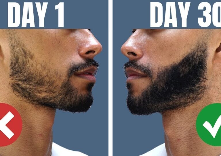 Patchy Beards – Tricks to Fill and Style a Thicker Beard